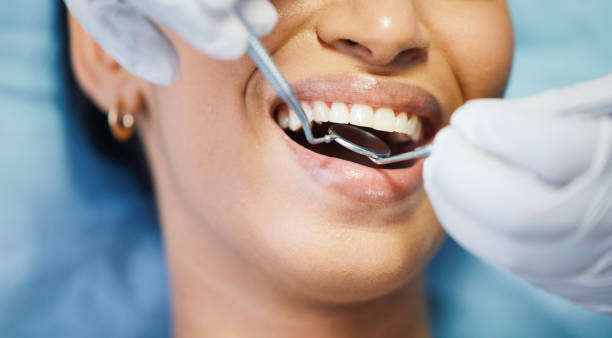 Best Urgent Care for Lost Fillings or Crowns in Boulevard Gardens, FL