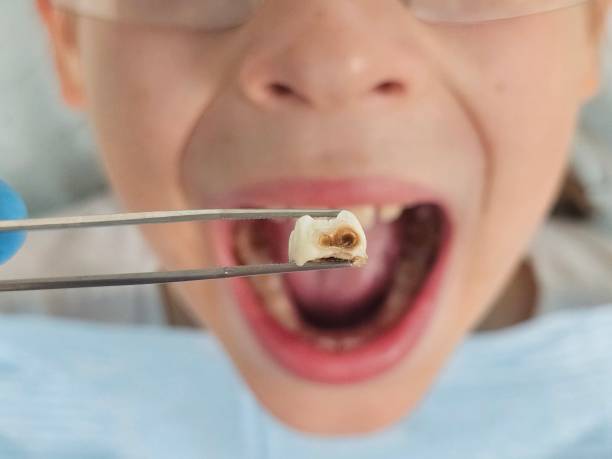 Best Weekend Emergency Dentist in Boulevard Gardens, FL