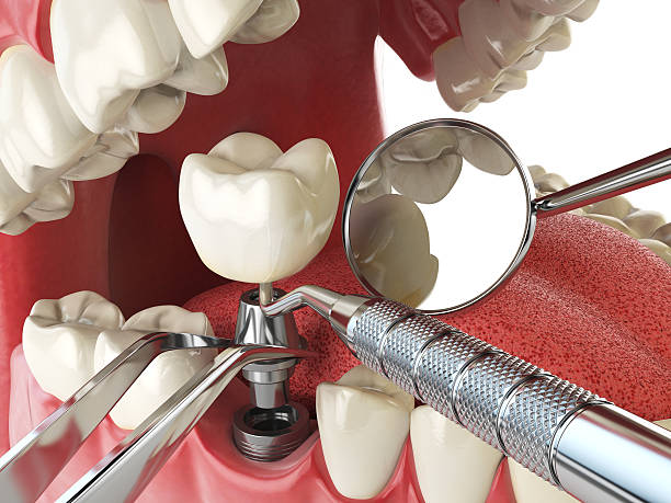 Best Cosmetic Emergency Dentistry in Boulevard Gardens, FL